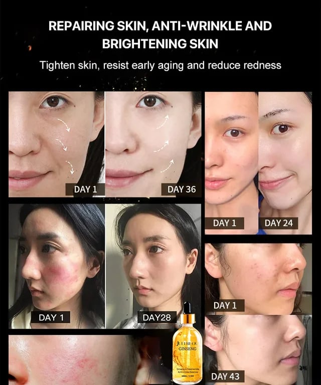 【⏰BUY 1 GET 1 FREE⏰】Hot sale ginseng polypeptide anti-ageing essence