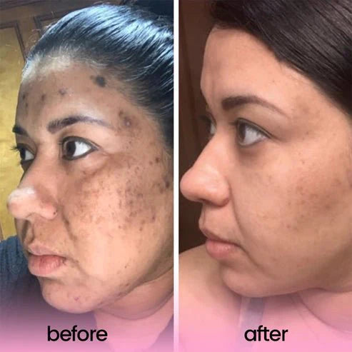 Comflux™ Turmeric Moisturizing Face Cream - Essential Hydration