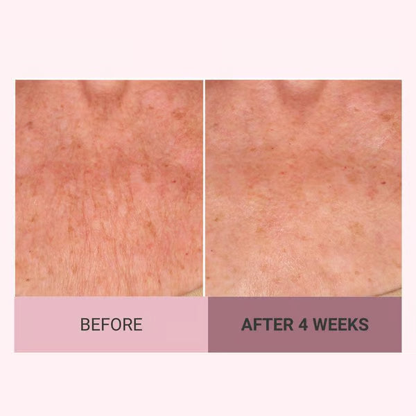 🌿Last Day Promotion 49% OFF - Champagne Beaute Lift Firming Body Crème🏆️Collagen regeneration