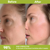 Retinal Shot Tightening Booster