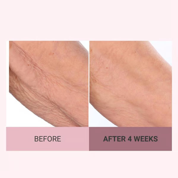 🌿Last Day Promotion 49% OFF - Champagne Beaute Lift Firming Body Crème🏆️Collagen regeneration