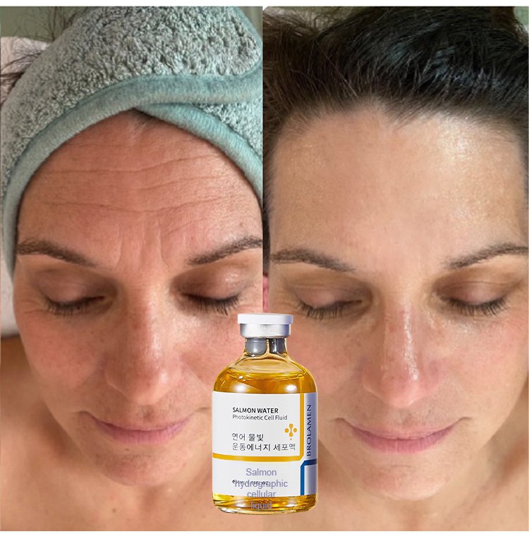 🎁BUY 1 GET 1 FREE🔥Salmon Water Light Anti-Wrinkle Essence