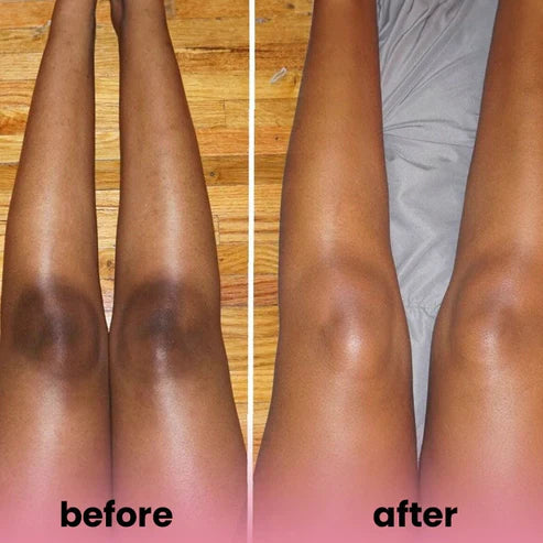 Turmeric kojic acid soap