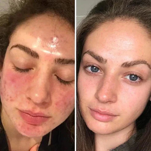 Comflux™ Brightening Set